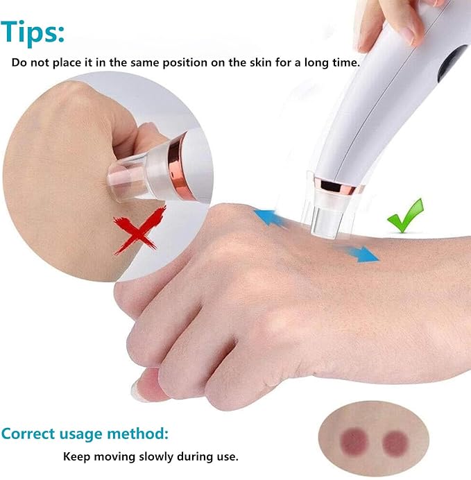 Eversmooth Porelift Blackhead Vacuum Removers,2026 Pore Vacuum Cleanser for Face,USB Rechargeable 3 Levels Adjustable Vacuum Blackhead Remover,with 5 Suction Power,6 Probes,for Women & Men (White)