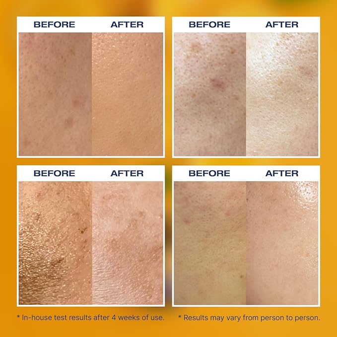 MINTAVI20 20% Vitamin C Serum with Ascorbic Acid, Alpha Arbutin & Tranexamic Acid for Brightening Dark Spots | Korean Skin Care for Radiant, Even-Toned Skin, 26ml / 0.879 fl. oz