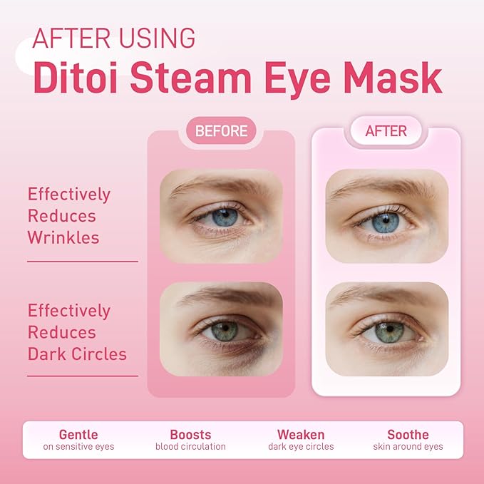 Ditoi Steam Eye Mask, Heated Eye Mask for Sleep,Warm Compress with Hyaluronic Acid,Moist Heat for Dry Eye Relief,Spa,Stye Eye Treatment,Travel Essentials & Relaxation Gifts,Rose 10 Packs