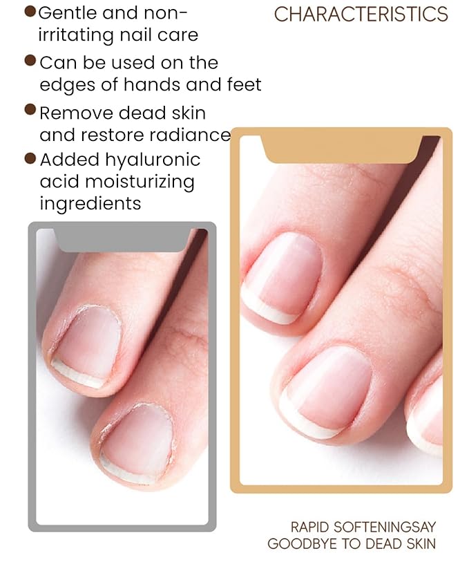 Nail & Cuticle Softener Spray - 100ml Fast-Acting Russian Pre-Treatment Liquid, Nail Polish Pre-Liquid, Softens Thick Toenails & Dead Skin, Hydrating Hyaluronic Acid Formula