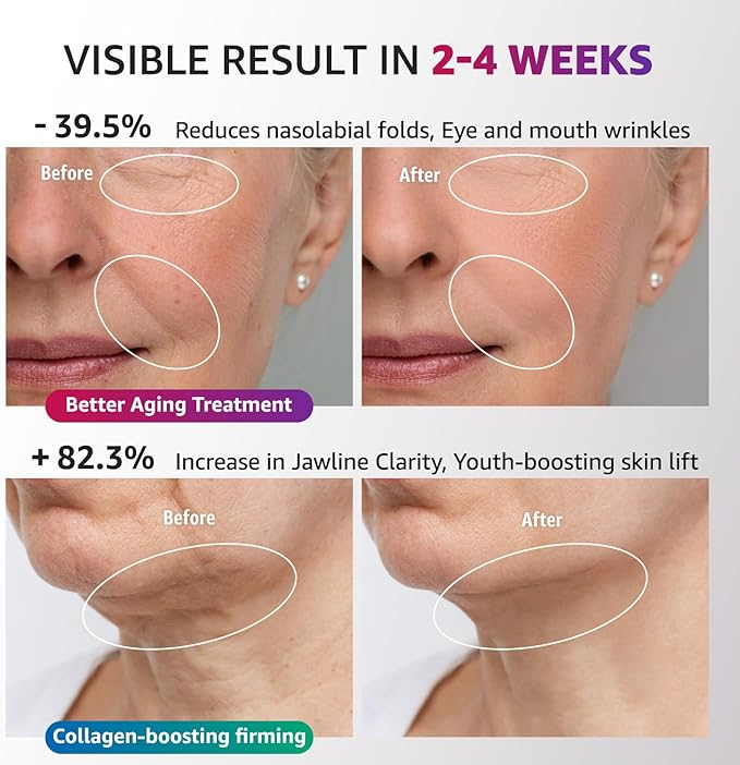 Red Light Therapy for Face and Neck, Renewal Face Lift Device with Vibration Tech, 3 in 1 Face Massager Tool with Thermals, True Beauty Glow Facial Sculptor for Wrinkles, Double Chin