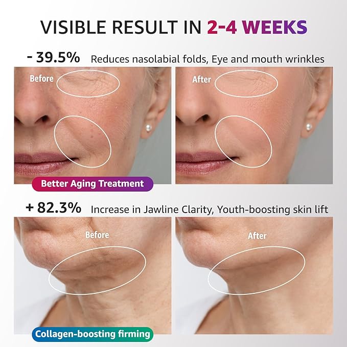 Red Light Therapy for Face and Neck, Renewal Face Lift Device with Vibration Tech, 3 in 1 Face Massager Tool with Thermals, True Beauty Glow Facial Sculptor for Wrinkles, Double Chin-White