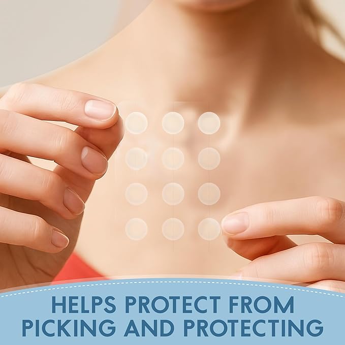 Zovira Invisible Patch-Daytime Niacinamide, Salicylic Acid, Tea Tree and Neem Oil Acne Pimple Patch (36ct) Suitable For Sensitive Skin-Tapered Edges Blends Into All Skin Tones Reduce Redness in 15 Min