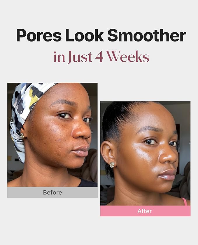 Delere Caviar Glow Smoothing Serum | Caviar Collagen with Niacinamide and Retinol for Face | Korean Serum for Glowing Skin and Radiant Glass Skin, 1.7oz