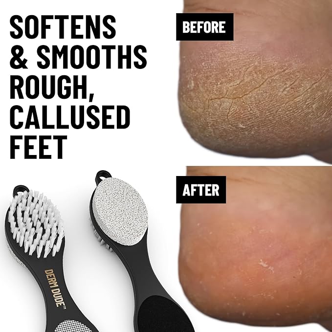 Derm Dude Holy Foot Repair Set | 2X Foot Creams Plus 4-in-1 Foot Scrubber Repair Tool | W/All-Natural DeoPlex for Odor Control - MPV & Strawberry