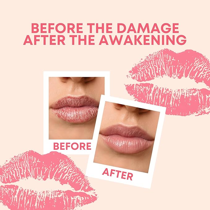 Rayvia - Red Light Therapy Device for Face, Lips - Lip Plumper - Collagen Booster - Anti-Aging Skincare Tool for Women - Fine Line Reducer - Blue Light Whitening Mouthpiece - Home Beauty (Rose Gold)