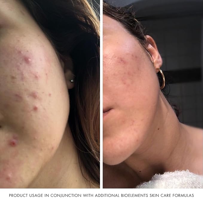 Bioelements Crucial Moisture - 2.5 fl oz - Emollient Cream Facial Moisturizer for Dry Skin - Improve Fine Lines - Vegan, Gluten Free - Never Tested on Animals - AM Moisturizer - Face Lotion