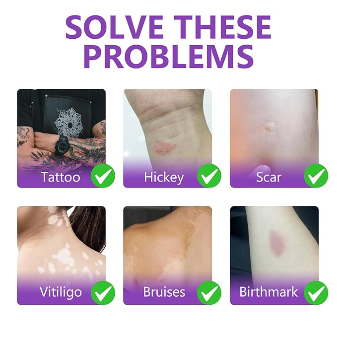 Tattoo Cover Up Makeup Waterproof, 2 Colors Tattoo Concealer, Invisible Tattoo Cover Up, Suitable for Tattoos Scars and Spots, for All Skin Types