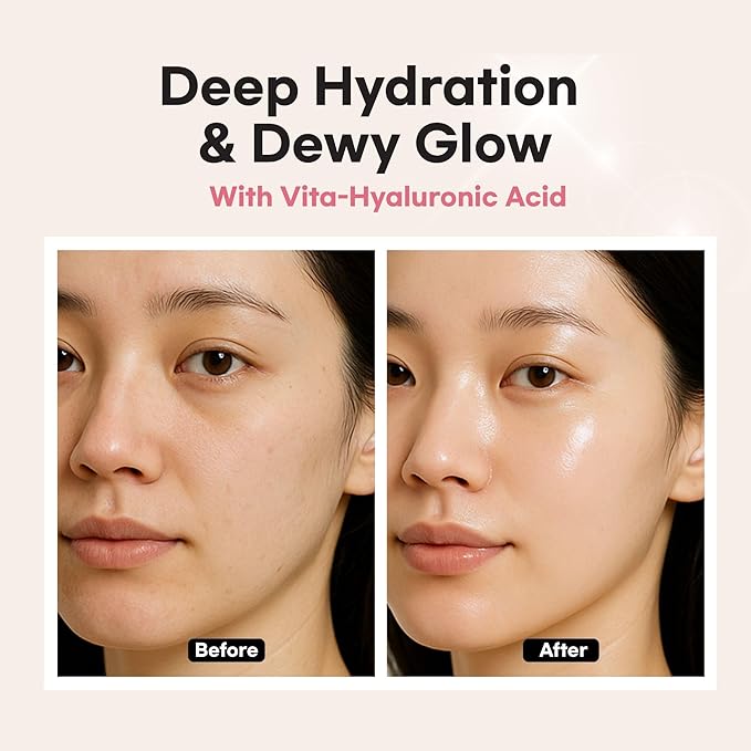 Intensive Hydro Radiance Serum, Dewy & Deep Hydration, Glow Glass Skin, Anti-aging care with Niacinamide, Vitamin C, Collagen, Korean Skin care 1.69 fl oz