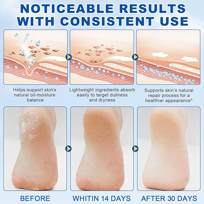 Urea Cream 60 Percent for Feet, 2% Salicylic Acid Urea Foot Cream for Cracked Heels and Dry Skin, Deep Moisturizing, Cracked Heel Repair Cream, Repairing Creams for Heels, Knees, Elbows & Hands (1)