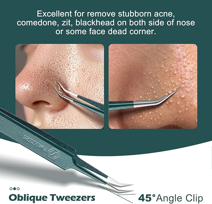 WSYUB Blackhead Tweezers,Upgrade Professional Facial Blackhead Remover Tweezers, Extraction Tools for Estheticians,Ingrown Hairs Tweezers