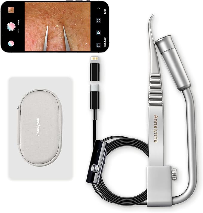 Luma 1 Visual Black Head Remover Tweezers with Camera - Pimple Popper Tweezers with Camera 20x Magnification, 1080P, 8 LED Lights, Dolphin Design Non-Magnetic Tweezers, Pore Cleaner