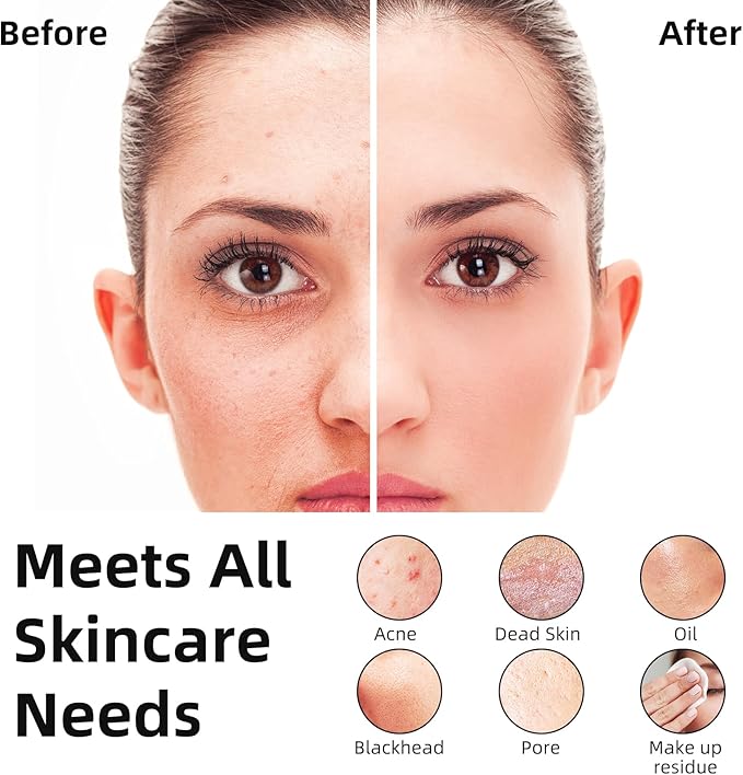 Facial Cleansing Brush Portable Waterproof Rechargeable Face Wash Brush, Electric Deep Cleaning for Men & Women (Black)