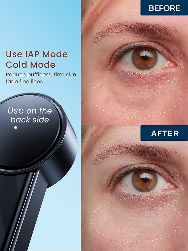 Radio Frequency Skin Tightening Device, Smart Electric Zinc Alloy Facial Beauty Machine with RF-Current Cold Heat for Jawline Lifting, Cheek Firm, Wrinkle Reduction, Depuff, Increase Absorption