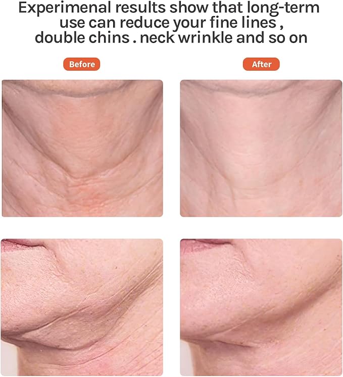 Red Light Facial Massager, Skin Care Tools for Face & Neck Beauty Device, 3 in 1 Face Massager Tool with LED, Thermal, Vibration, Tightenings, Rejuvenation for Women