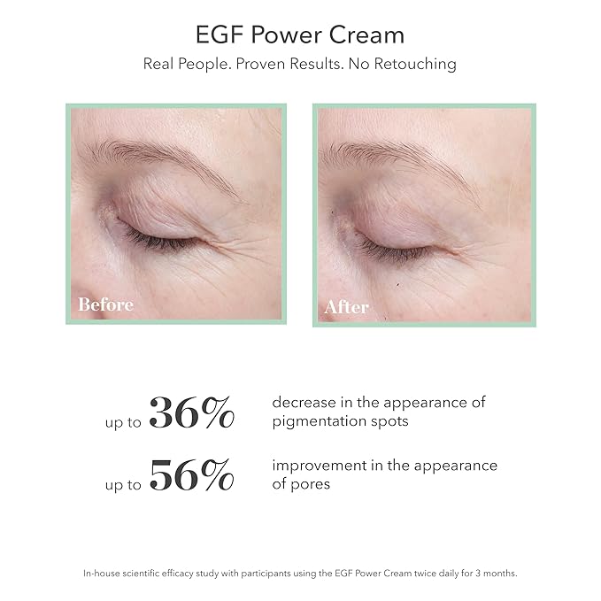 BIOEFFECT EGF Power Cream | Advanced Age-Defying Face & Neck Cream with Epidermal Growth Factor + Hyaluronic Acid + Niacinamide for Wrinkles & Age Spots | 50 mL / 1.69 oz