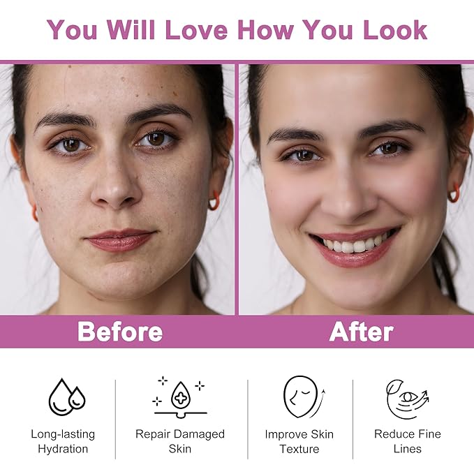 Skincare Gifts Set for Women,Skin Care Set Kit,Hydrating Moisturing Repairing Soothing Snail Mucin Facial Skin Care Routine Kit for Dull Skin & Dry Skin,Travel Skin Care Gift Set Women Teens Mom Wife