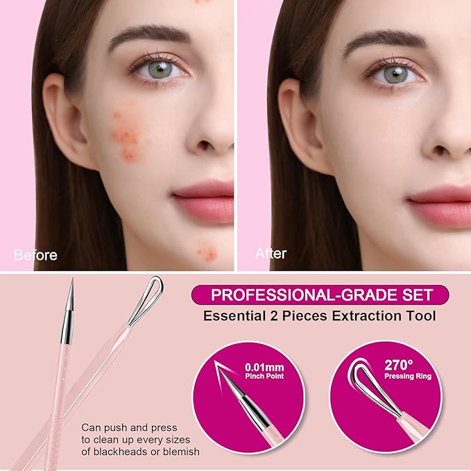 Teenitor Pimple Extractor Acne Treatment Tool Blackhead Comedone Removal 2-in-1 Popper Tool for Face Blackhead Extractor Tool Pink