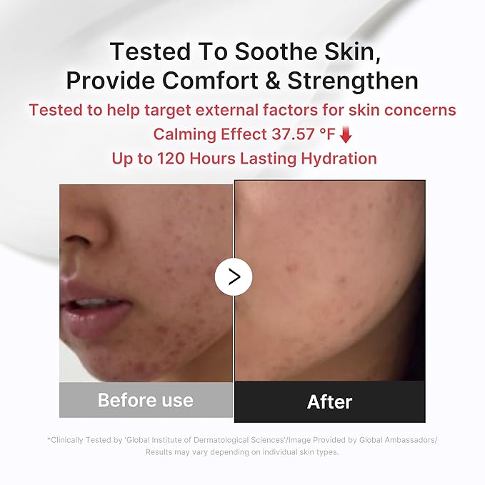 medicube 3H Daily Relief Cream | Daily Soothing Moisturizer for All Skin Types | Lightweight Comforting Cream Ideal For Use After Spot Care | Guaiazulene, Centella, Ceramide for Balance and Hydration