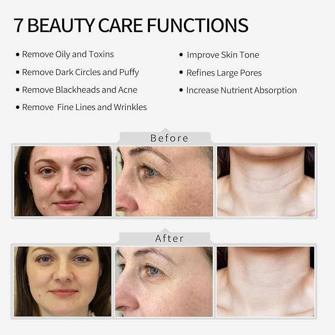 High Frequncy Skin Care Beauty Device Skin Tightening Facial Machine Face Neck Device Body Massager Tools Device Geneo X Elite Micro-Current Wrinkle Reduction Facial Service.Model EP-400