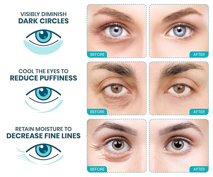 Stylia Collagen & Vitamin C Under Eye Patches for Puffy Eyes & Dark Circles - Depuffing, Hydrating & Firming Under Eye Mask with Hyaluronic Acid - Stocking Stuffers for Teen Girls, Vegan (30 Pairs)