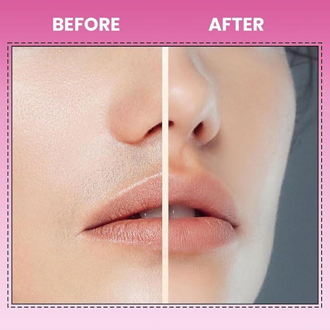 Facial Hair Remover for Women – Electric Face Razor with Light, Hair Removal for Upper Lip, Chin & Cheeks – Color Rose Gold