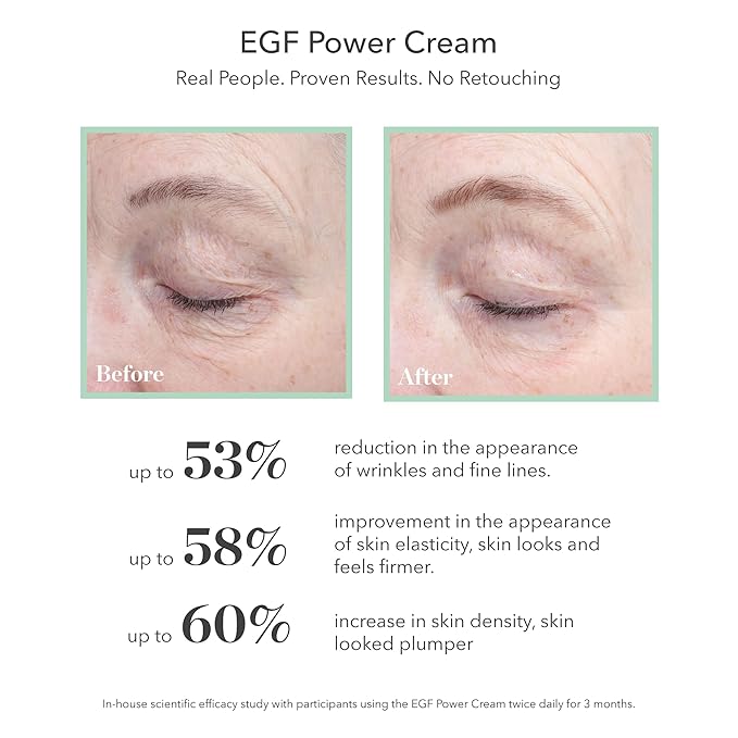 BIOEFFECT EGF Power Cream | Advanced Age-Defying Face & Neck Cream with Epidermal Growth Factor + Hyaluronic Acid + Niacinamide for Wrinkles & Age Spots | 50 mL / 1.69 oz