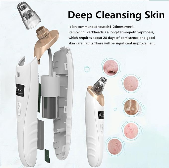 Eversmooth Porelift Blackhead Vacuum Removers,2026 Pore Vacuum Cleanser for Face,USB Rechargeable 3 Levels Adjustable Vacuum Blackhead Remover,with 5 Suction Power,6 Probes,for Women & Men (White)