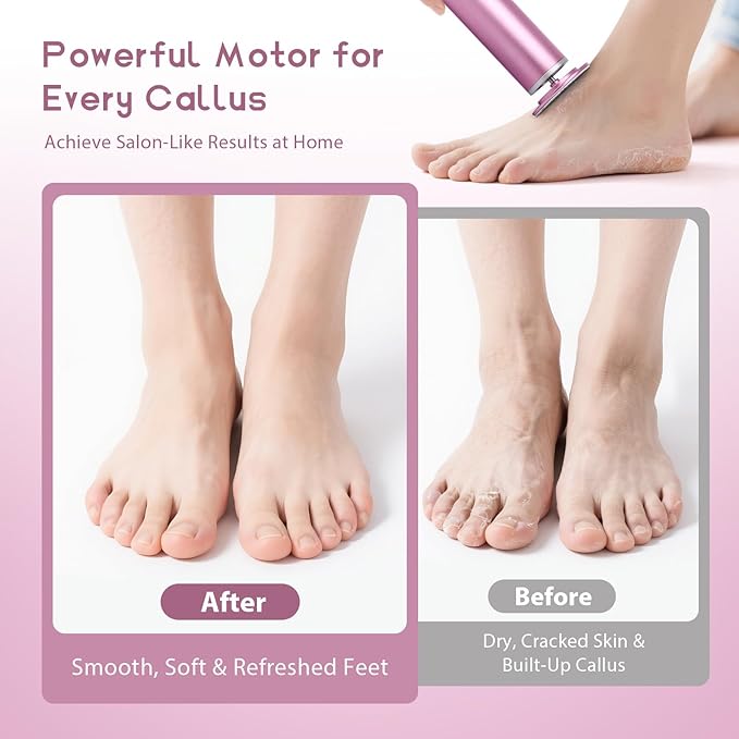 Electric Foot Callus Remover with 60pcs Sandpaper Discs, 4.8IN Aluminum Foot File for Dead Skin and Cracked Heels, 800RPM Professional Pedicure Tool for Home Spa Use