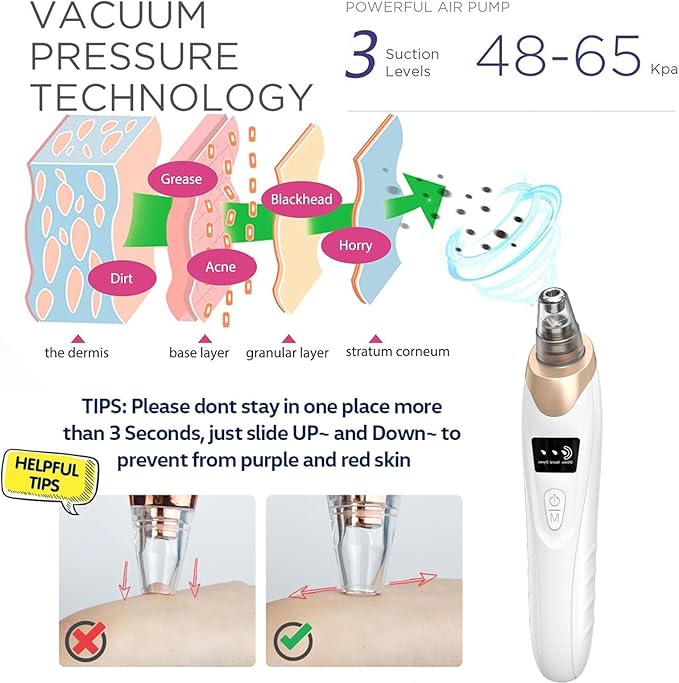 Eversmooth Porelift Blackhead Vacuum Removers,2026 Pore Vacuum Cleanser for Face,USB Rechargeable 3 Levels Adjustable Vacuum Blackhead Remover,with 5 Suction Power,6 Probes,for Women & Men (White)
