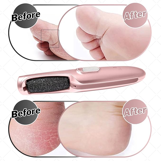 Powerful Electric Callus Remover Wand – Rechargeable Foot File, Grinder & Scrubber - Removes Dead, Hard Skin & Calluses – Best Pedicure Tool for Soft, Smooth Feet for Men & Women (Rose Gold)