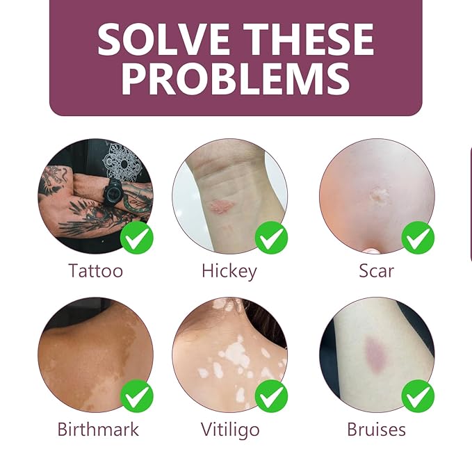 Tattoo Cover Up Makeup Waterproof, 2 Colors Tattoo Concealer, Invisible Tattoo Cover Up, Suitable for Tattoos Scars and Spots, for All Skin Types1