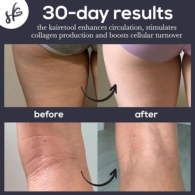 Kairetool Face & Body Massager, Lymphatic Drainage, Deep Tissue Massage, Pressure Point Therapy for Depuffing and Debloating, Fascia and Myofascial Release, Reduces Look of Cellulite, Jade