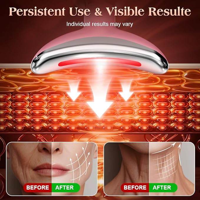 Face and Neck Massager Tool with Heat & 3 Light Therapies, Smart Vibration, Red-Light-Therapy and EMS Modes, Gua Sha Facial Tools for Face and Neck Skin Care and TMJ Relief