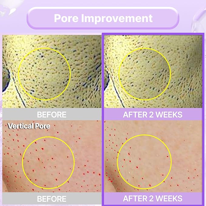 BIOHEAL BOH Probioderm™ Collagen Remodeling Cream 1.69 fl oz (50 ml) | Pore Tightening Cream with 150,000 Collagen Capsules for Firmness & Smooth Texture | Lightweight Moisturizer for Flawless Skin