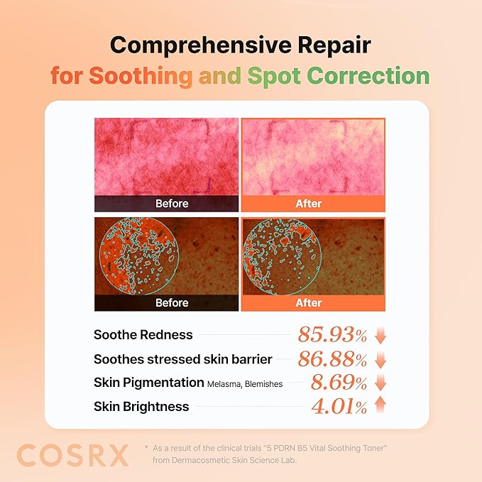 COSRX 5 PDRN B5 Vital Soothing Toner - Korean Toner for Rejuvenating & Soothing Skin with Salmon DNA, Centella, Lactobacillus PDRN & Panthenol, Korean Skin Care (280ml/9.46 fl.oz.)