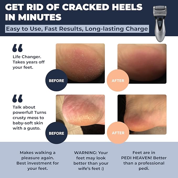 Electric Callus Remover: Rechargeable Electronic Foot File CR900 by Own Harmony(Tested Most Powerful) Best Pedicure Tools w 3 Rollers Professional Pedi Feet Care Sander for Cracked Heels and Hard Skin