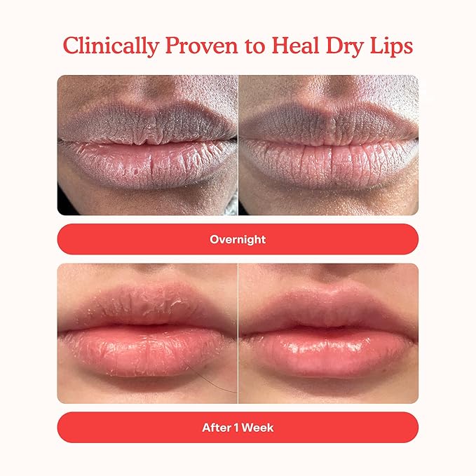 Tower 28 LipSoftie Hydrating Tinted Lip Treatment Balm, Moisturizing Lip Mask for Chapped Lips - Sugar Plum Flavor, Sheer Mauve