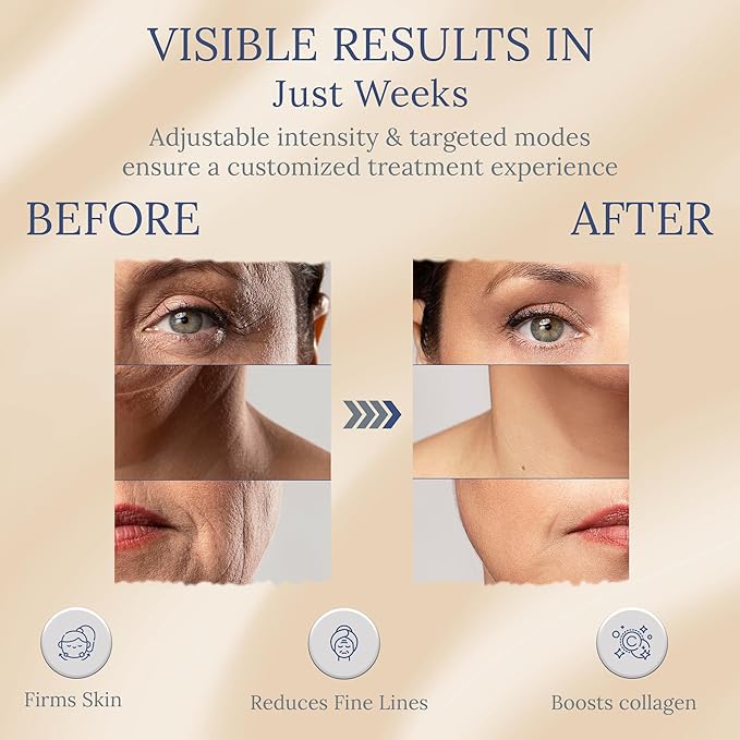 Skin Firming Facial Device, 6-in-1 Beauty Device for Home Use, 5-Level Skin Rejuvenation and Toning Tool for a Radiant Glow