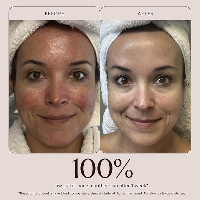 True Botanicals Chebula Active Serum | Anti-Aging Face Serum | Reduces Appearance of Fine Lines & Wrinkles | Optimizes Skin Collagen Levels | Dermatologist Tested, Vegan, All Natural |1 fl oz | 30 ml