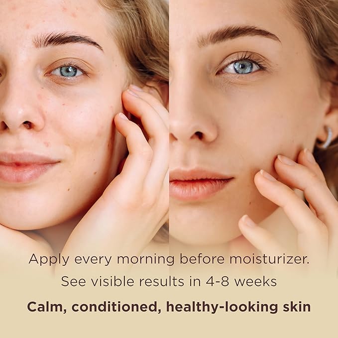 MATKAS Korean Antioxidant 2% Niacinamide Serum for Face with Cica - 30mL - Hyaluronic Acid Moisturizer and Centella Ampoule Serum for Glowing Skin, Anti Redness Niacinamide Pore Minimizer + Ceramide