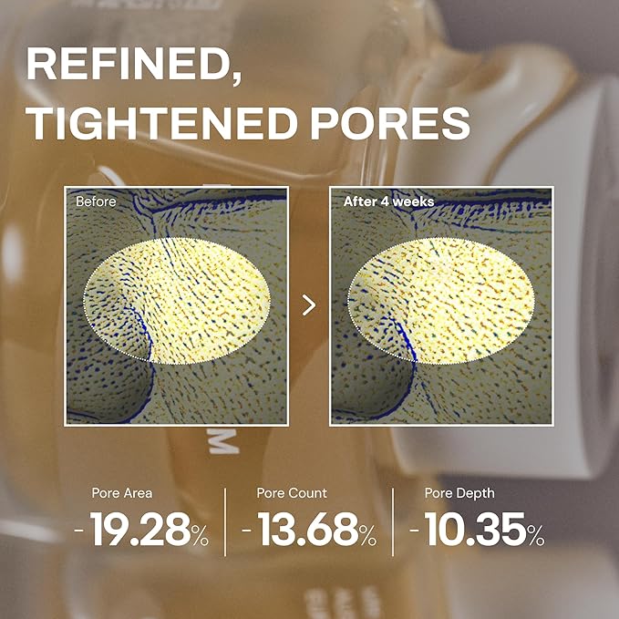 Whamisa Organic Cactus Magic Serum, Anti-Wrinkle & Brightening, Renewing Care, Skin Barrier Support, Fermented Ingredients, Hydrating, Facial Ampoule, Pore Refining, Korean Skin Care (32ml)