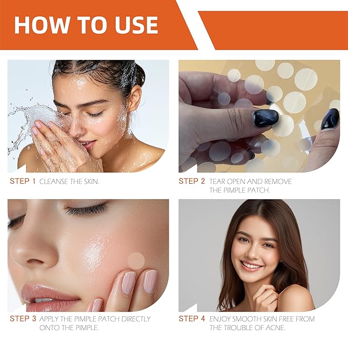 (5¢ Each) Pimple Patches 324 Pack - Hydrocolloid Acne Patches with Salicylic Acid & Tea Tree Oil - 4 Sizes S/M/L/XL - Face Acne Treatment - Easy Peel Perforated Sheets