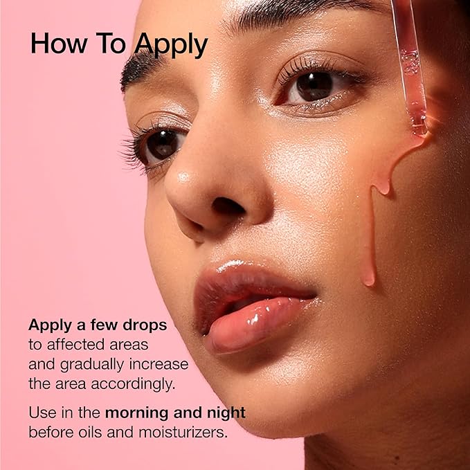 ANUA Niacinamide 10 + TXA 4 Serum, Hyaluronic Acid, Tranexamic acid, Facial Serum For GlassSkin, Glow Back Serum, Dark Spot Care, Postnatal Skincare, Korean Skincare (30ml/1.01 fl.oz)