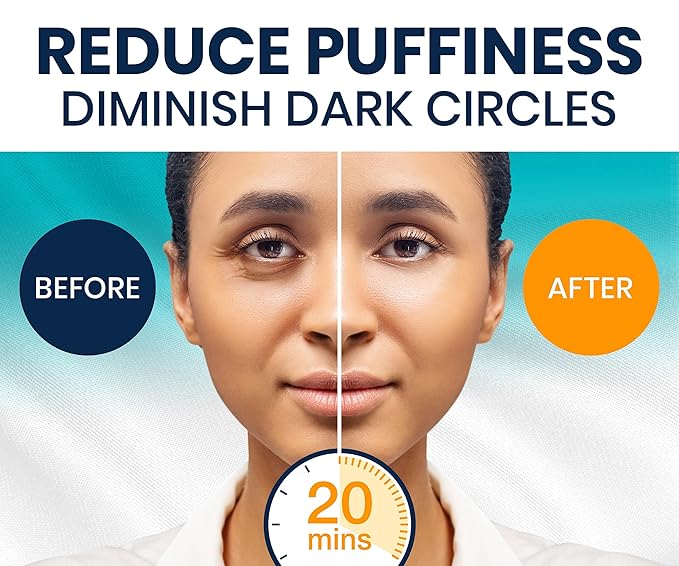 Stylia Collagen & Vitamin C Under Eye Patches for Puffy Eyes & Dark Circles - Depuffing, Hydrating & Firming Under Eye Mask with Hyaluronic Acid - Stocking Stuffers for Teen Girls, Vegan (30 Pairs)