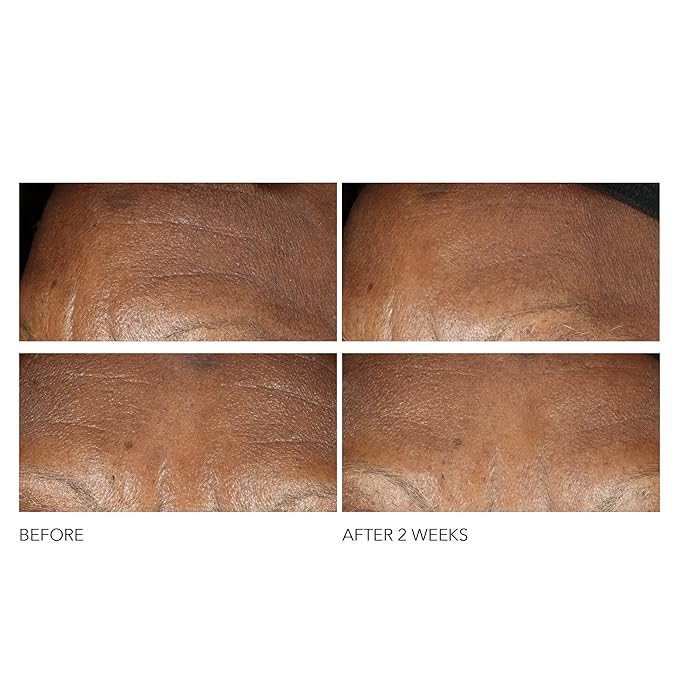 Dr Dennis Gross Advanced Retinol + Ferulic Intense Wrinkle Cream | Intensely Hydrating to Visibly Transform Skin and Repair the Moisture Barrier | 2 oz