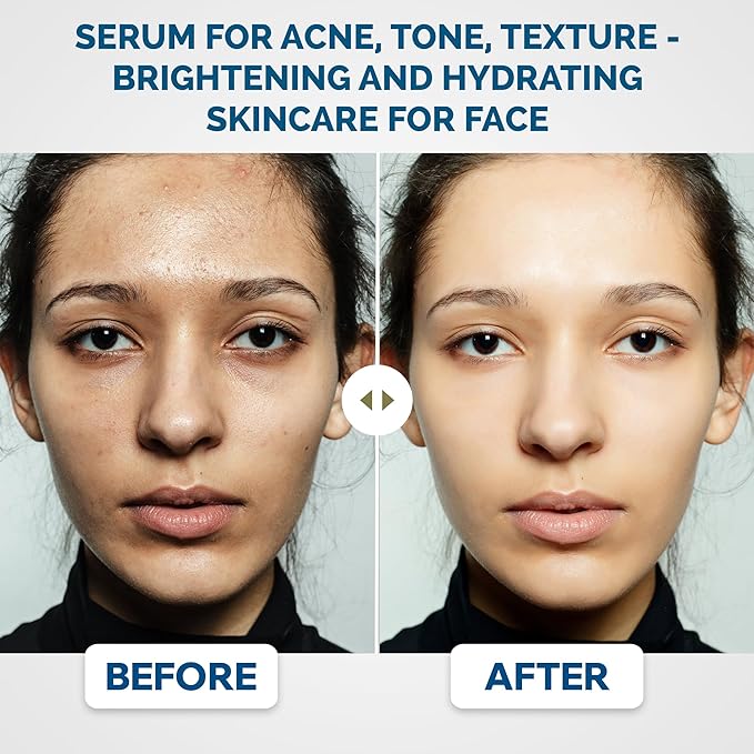 Radiant Eye Care Bundle – Age-Defy Serum + Red Light & Microcurrent Under-Eye Device for Bright, Firm Skin