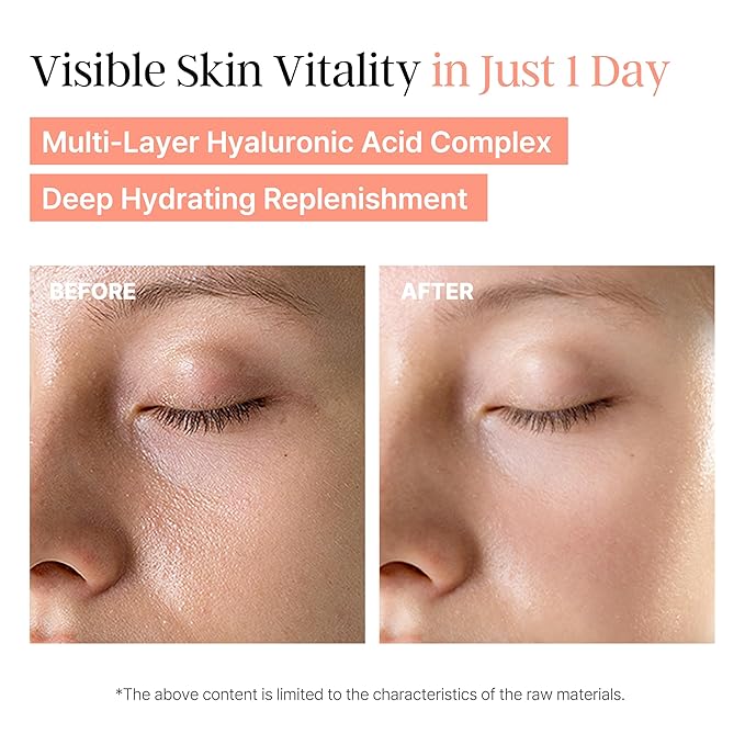 PeachMicrobiome 84 EGF Serum | Peach Growth Factor Anti-Aging Serum | Niacinamide, Multi-Layer Hyaluronic Acids, Collagen | Boost Firmness & Vitality, Long-Lasting Moisture | Korean Skin Care