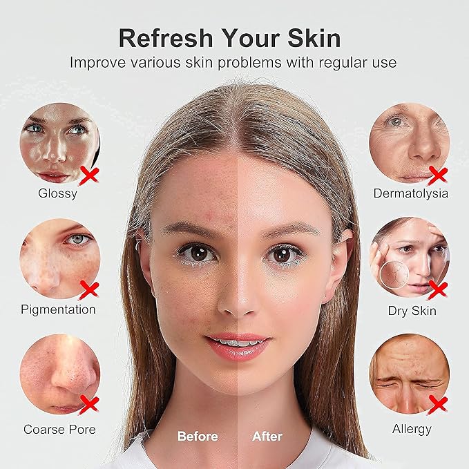 Newbealer Facial Steamer, Mini Aroma Face Steamer, Nano Ionic Hot Mist Facial Humidifier Atomizer, Home Sauna Spa Sprayer Moisturizing Cleansing Pores, 9 Pieces Acne Remover Kit (Pink-Gold, 160ml)