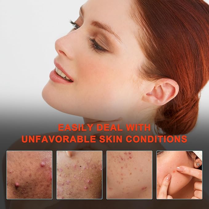 Elitzia Red Light Therapy Electronic Patch 6-Pack Reusable Hydrocolloid Patch Reduce Blemish Unclog Pores Skin Care for Sensitive Skin Home Use ETEAP6